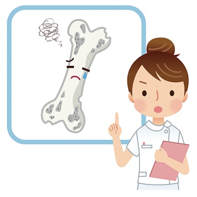 保健師がスカスカになった骨をチェックしているイメージイラスト