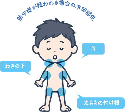 熱中症が疑われる場合の冷却部位のイメージ図